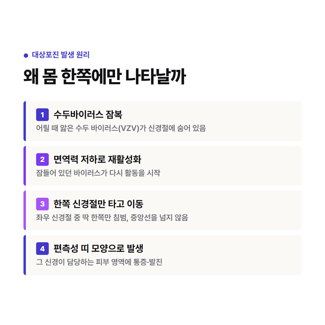 대상포진이 몸 한쪽 신경절을 따라 발생하는 원리 - 편측성 띠 모양 분포